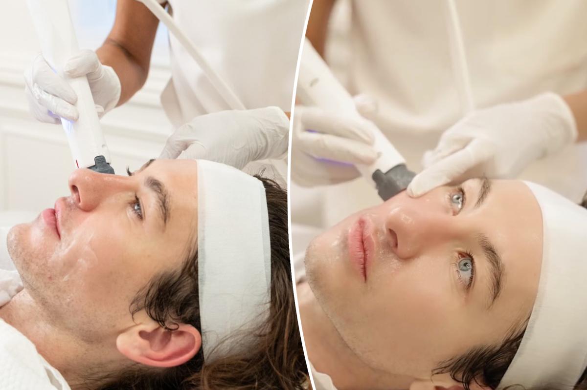 Barry Keoghan says Xerf face-tightening treatment made him 'look better'