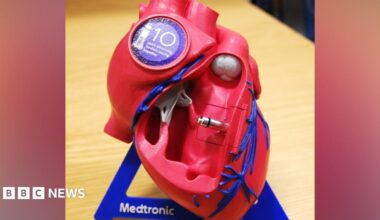 The leadless pacemaker, that is a small metallic-looking item, fitted inside a life-size model of a heart, that is made out of plastic, red, in colour, with blue veins.