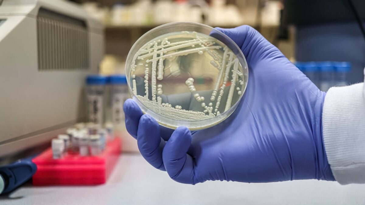 This Deadly Fungus Keeps Learning How to Beat Every Drug We Throw at It