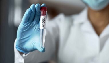 Ebola Virus: 7 things to know about causes, symptoms, prevention