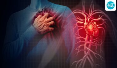 Can too much exercise harm your heart? Cardiologist shares warning signs you should never ignore