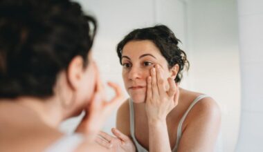 Do you have 'ferritin face'? 9 warning signs you're low on iron