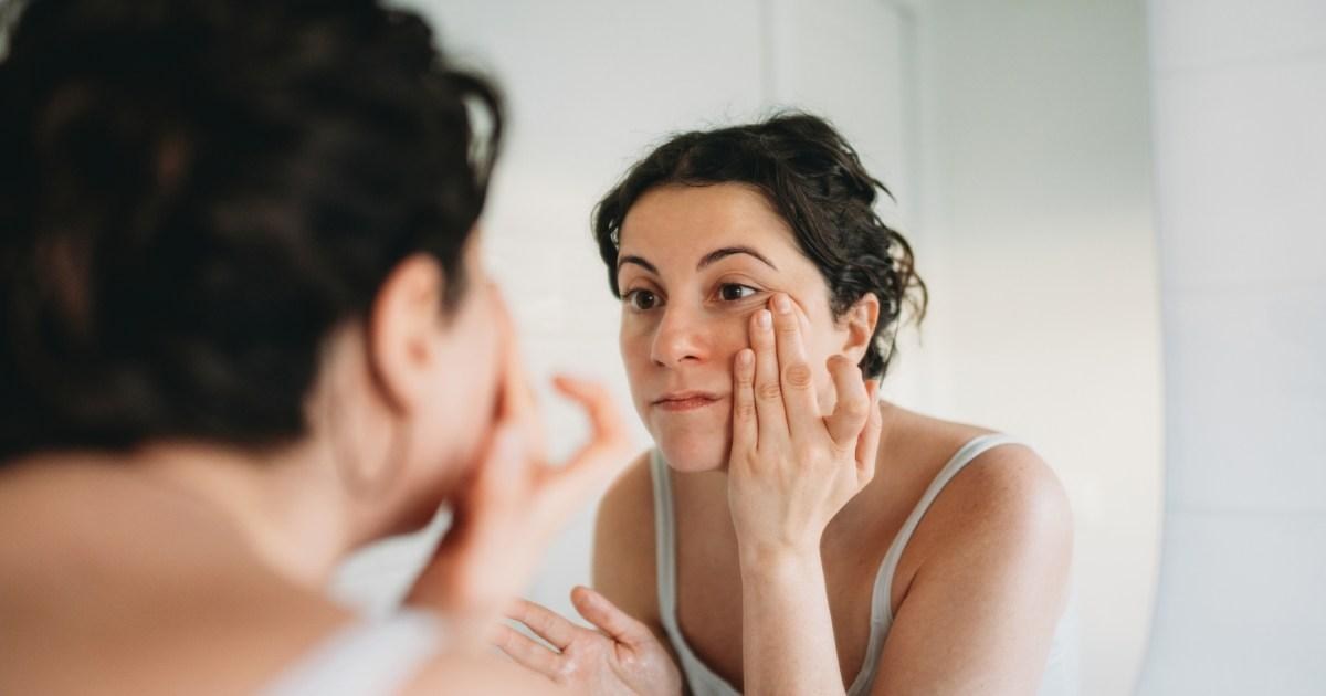 Do you have 'ferritin face'? 9 warning signs you're low on iron