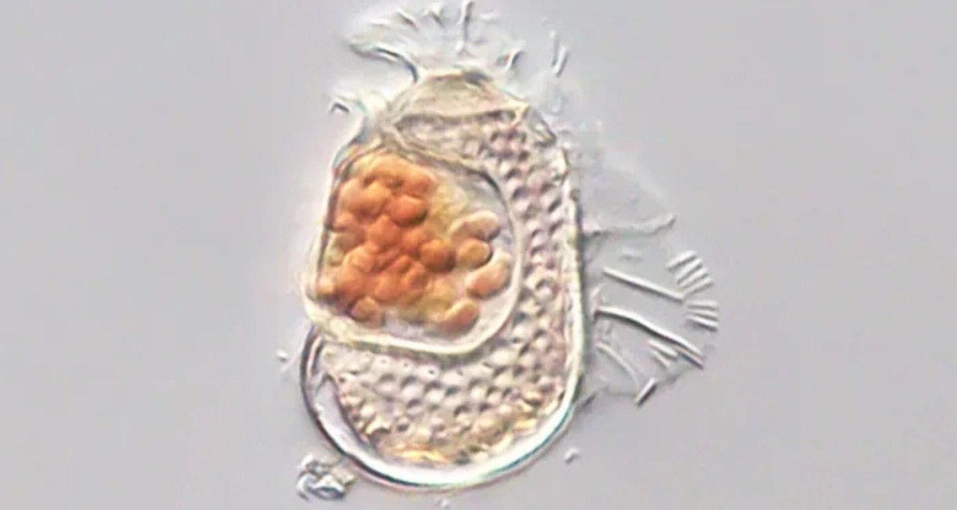 Microbe Discovered With One of The Smallest Genomes on Record, Pushing The Bounds of What It Means to Be Alive : ScienceAlert