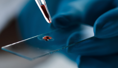 Researchers Developed a Molecule to Fight Alzheimer's – Then Found It's Already in Our Blood : ScienceAlert