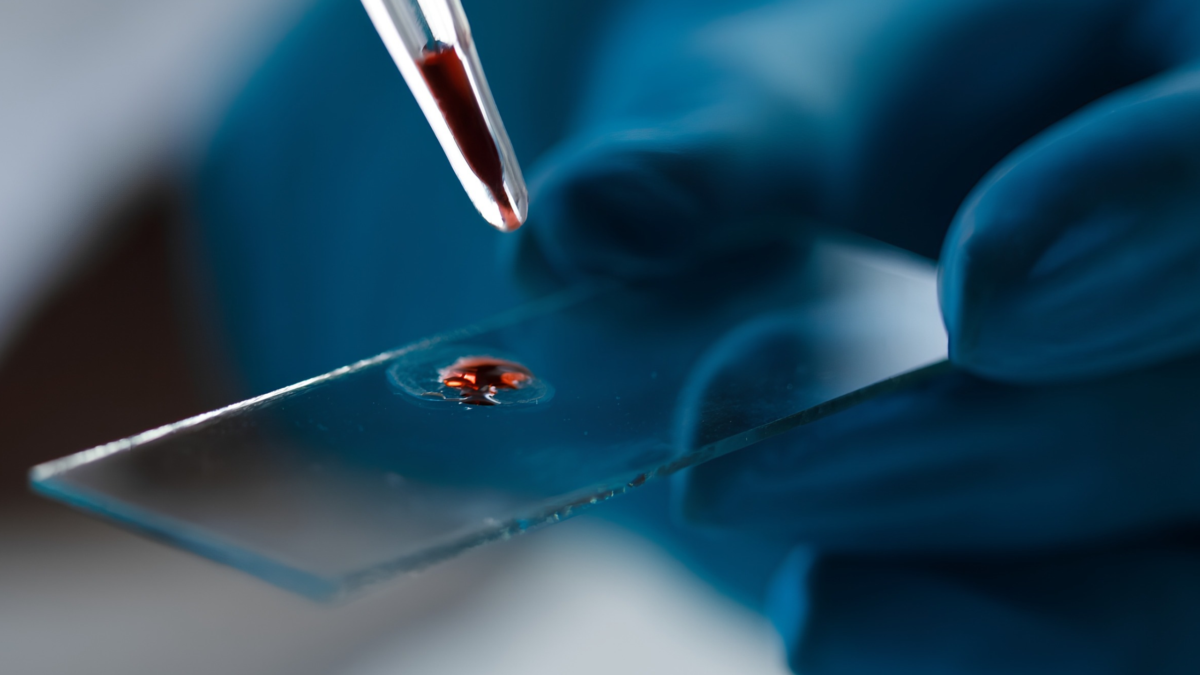 Researchers Developed a Molecule to Fight Alzheimer's – Then Found It's Already in Our Blood : ScienceAlert
