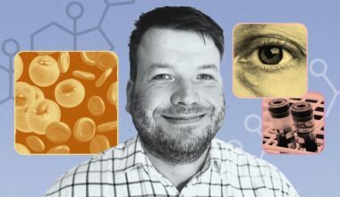 I’m a GP – this is what your cholesterol numbers really mean