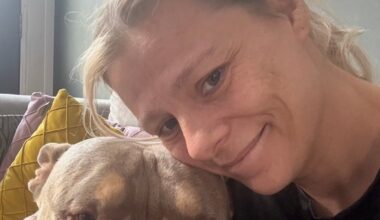 I had a stroke as a healthy 41-year-old – this is why it’s rising in the young