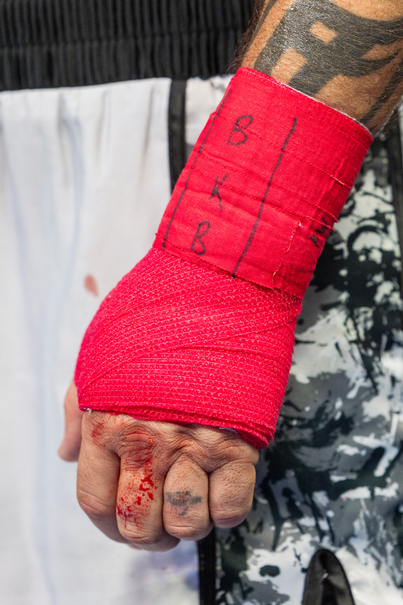 Terrill’s bloodied hand during the Anarchy In the UK event