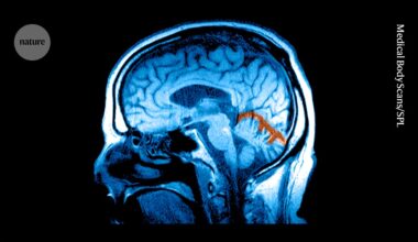 Can GLP-1s heal the brain? Obesity drugs get a makeover for addiction and depression