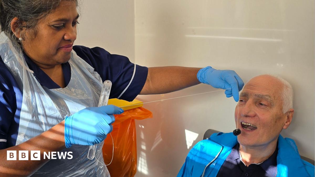 A healthcare worker wearing gloves and a protective apron removes a capsule sponge device from the mouth of a seated trial participant inside a mobile screening unit. The procedure uses a thread attached to a small sponge, which is collected after being swallowed and expanded in the stomach. The image illustrates the "pill-on-a-thread" test being used to collect cells from the oesophagus as part of oesophageal cancer screening research.