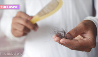 GLP-1 Users Intended To Lose Weight, But Many Of Them Say They’re Losing Hair Too