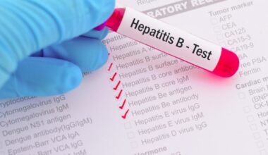 New Hepatitis B drug approved by US FDA offers patients a chance to ditch lifelong medication