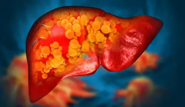 Eating late at night linked to up to 30% higher risk of liver disease