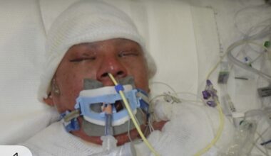 Social Workers at LA General Ask for Help IDing John Doe Patient