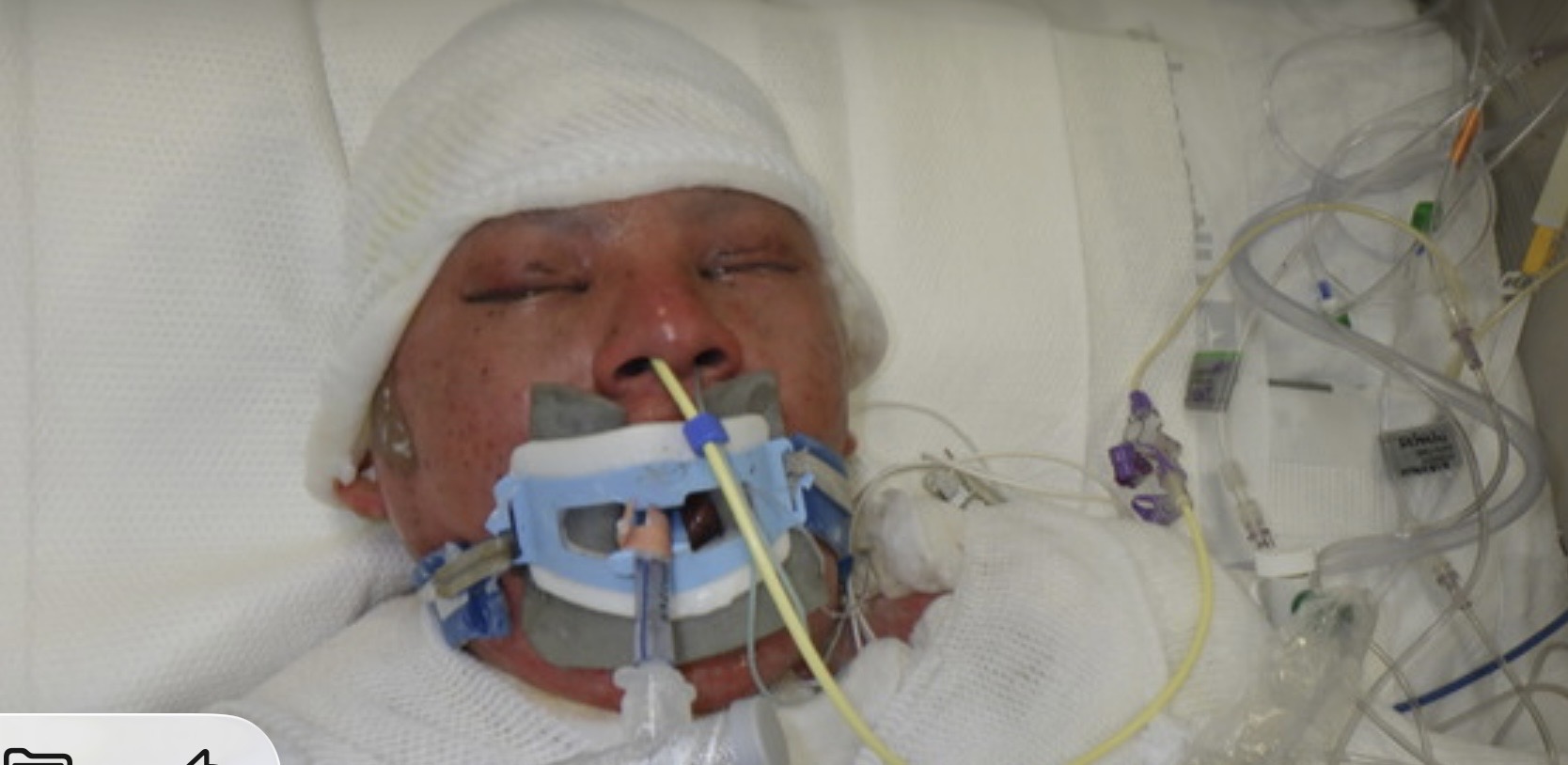 Social Workers at LA General Ask for Help IDing John Doe Patient