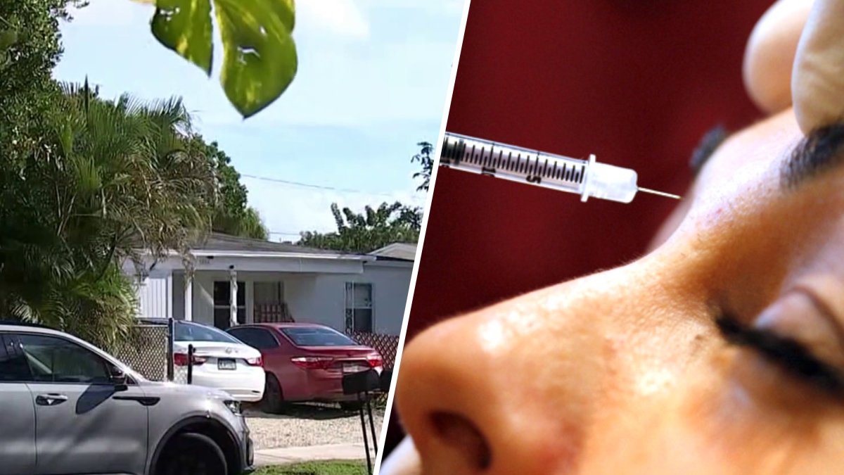 Oakland Park woman charged over illegal cosmetic procedures – NBC 6 South Florida