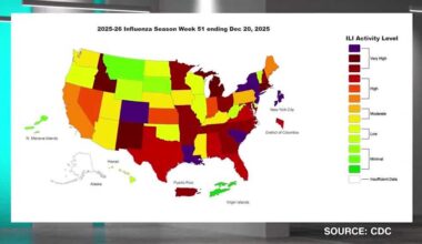 High flu levels reported in California. How do other states compare?