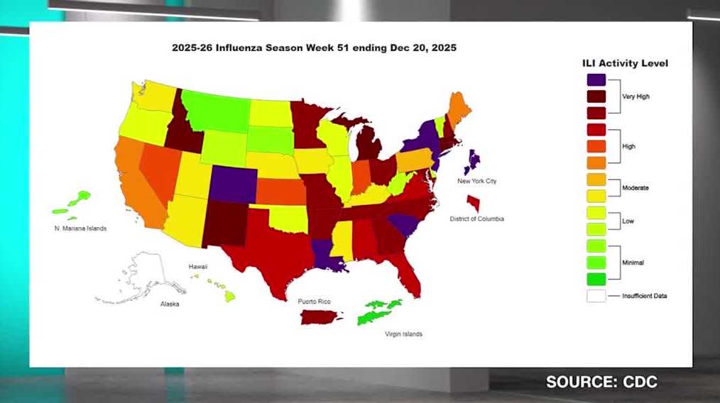 High flu levels reported in California. How do other states compare?