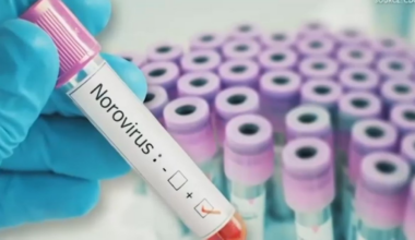 Norovirus cases on the rise in San Diego, health experts say – NBC 7 San Diego