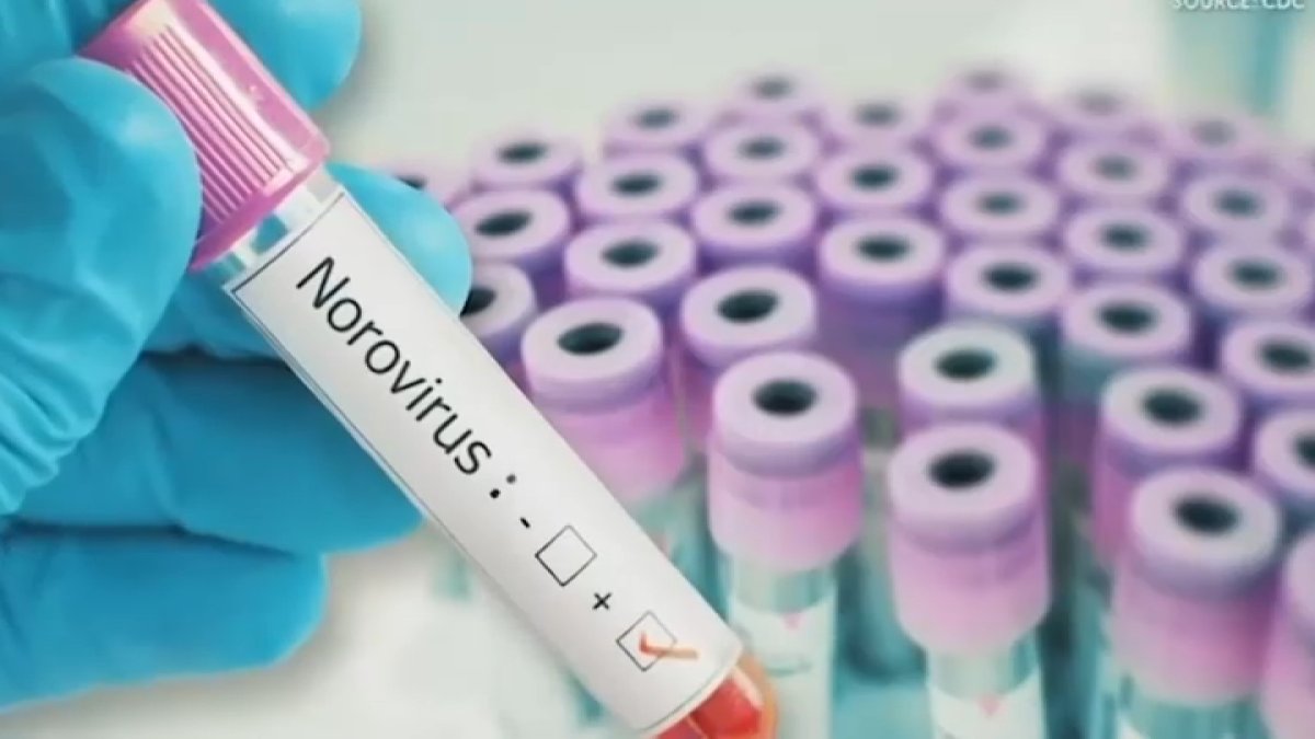 Norovirus cases on the rise in San Diego, health experts say – NBC 7 San Diego