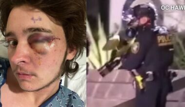 Anti-ICE protester claims he's now blind after federal officer shot him with nonlethal weapon in Santa Ana