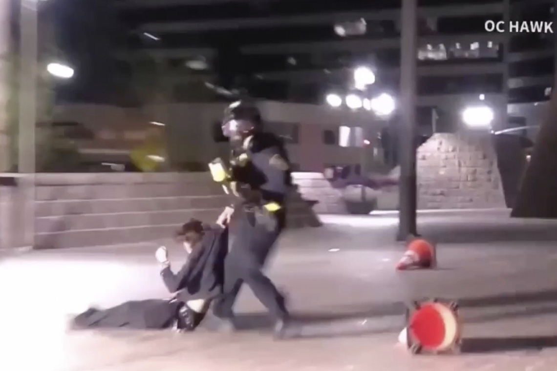 Demonstrator injured after federal agent fired projectile from close range during California protest