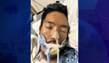 Hospital needs help identifying man found unconscious in Los Angeles
