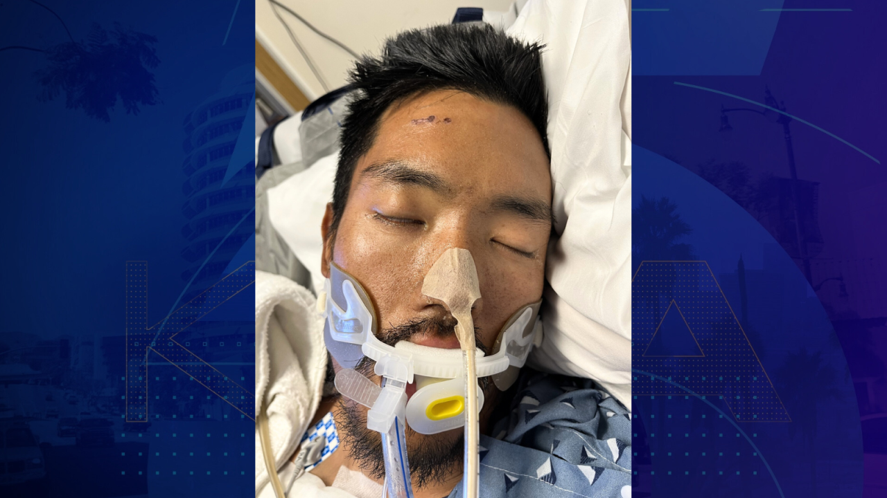 Hospital needs help identifying man found unconscious in Los Angeles