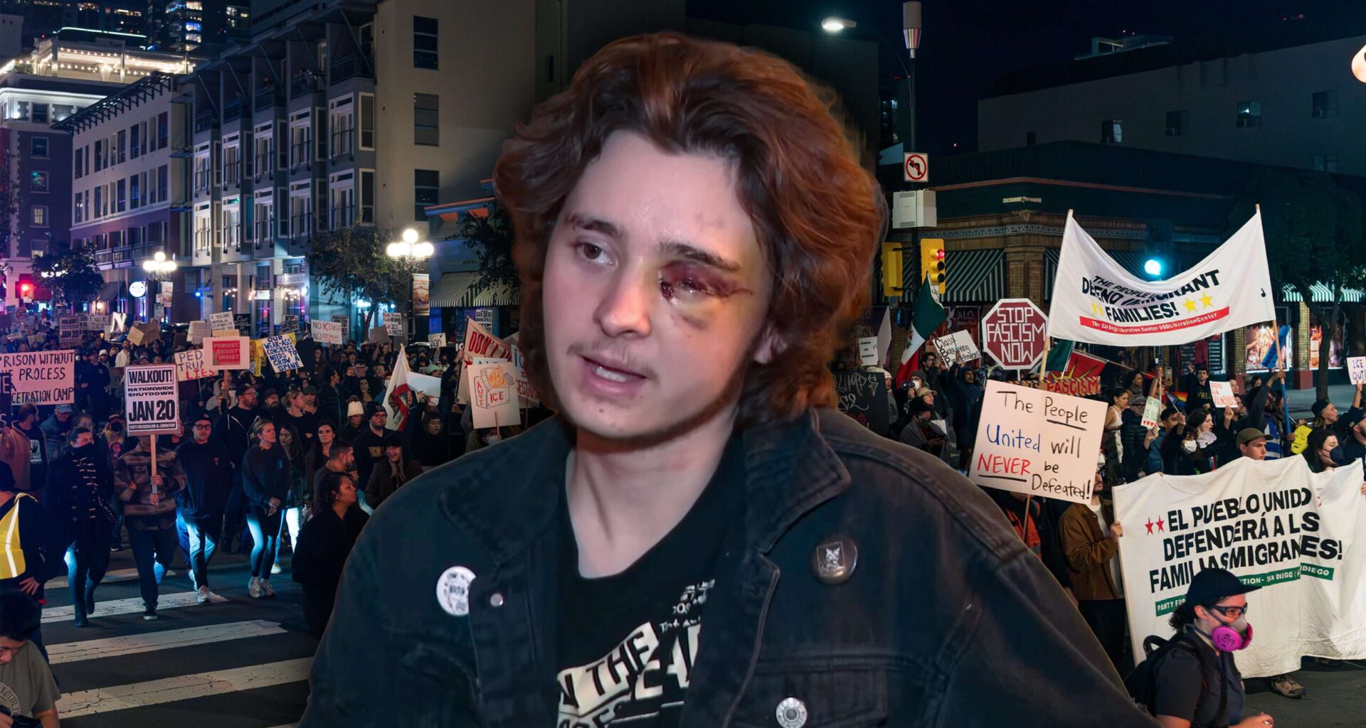 California man blinded by federal officer during ICE protest