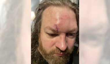 Disneyland fight leaves bloodied dad with stitches after ‘sucker punch’ – Orange County Register
