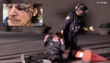 ‘No reasonable explanation’ for Homeland Security officer shooting Santa Ana protester in the face, blinding an eye, expert says