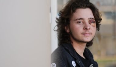Kaden Rummler, who was injured after being hit with a projectile fired by a federal agent during a protest outside an immigration building in Santa Ana, Calif., posed for a portrait.