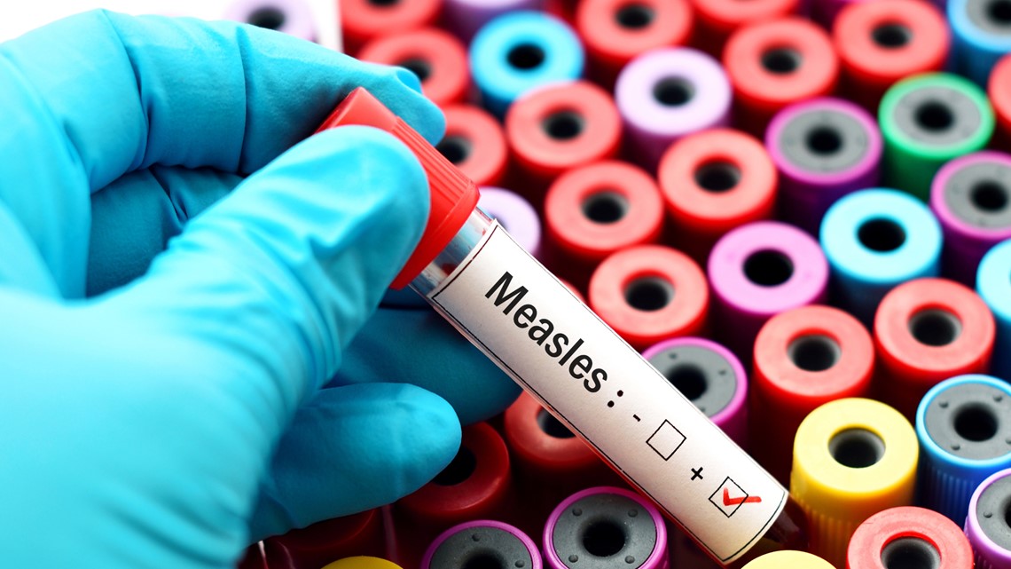 ABC News map shows measles risk by county. Here’s where Sacramento area stands