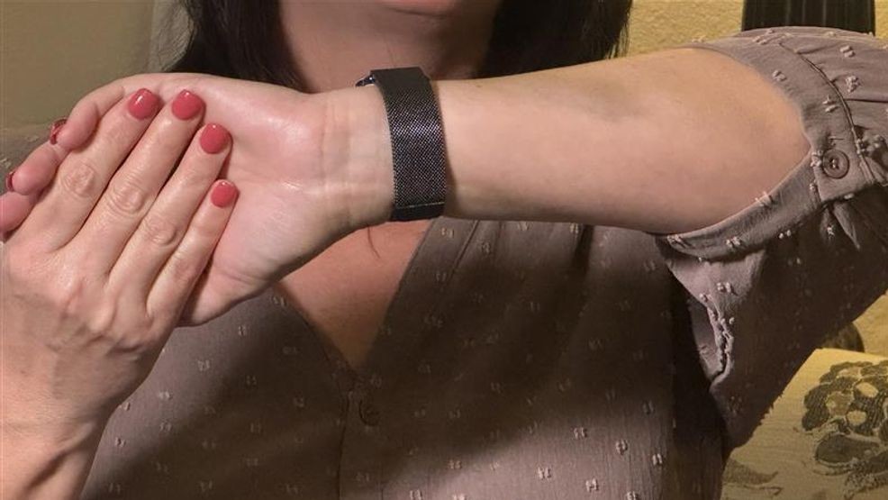 Only light bruising between she and her husband. (KMPH)