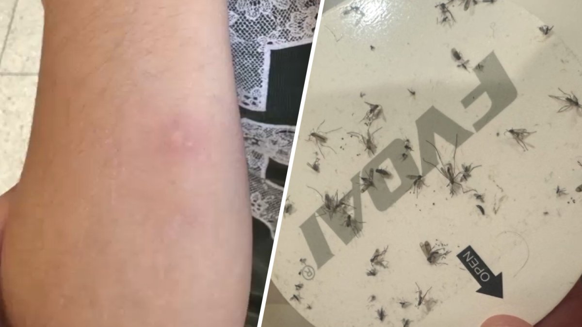 Mosquitoes are making El Segundo residents ‘miserable’ – NBC Los Angeles