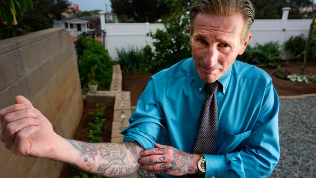 At his home for sober living in San Diego, Jeff Warren, 60, shows the track scars that come from his past addiction to heroin. Eventually Warren moved onto fentanyl and used it, as he describes, "every day all day."  Warren, who has been sober since July 6th, 2023, is employed and is pursuing his bachelor's degree in psychology with a focus on addiction. (Nelvin C. Cepeda / The San Diego Union-Tribune)