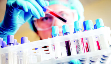 Innovative REACH study enhances early cancer detection • Brand stories