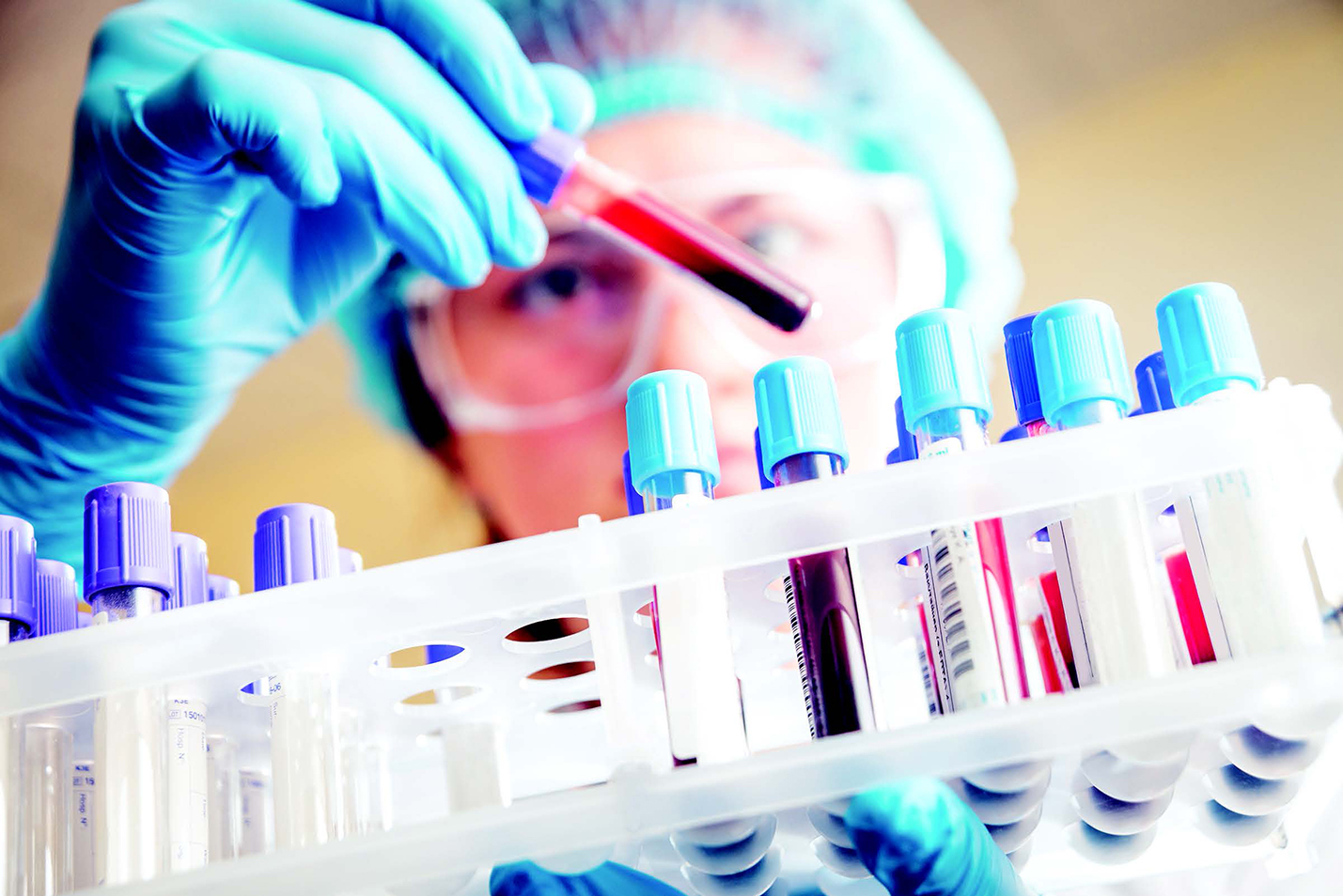 Innovative REACH study enhances early cancer detection • Brand stories