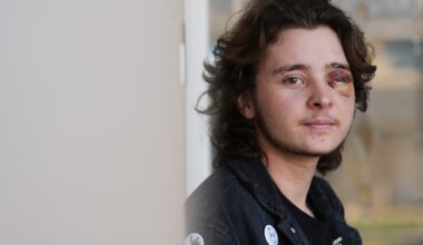 California protester blinded in one eye says his life will never be the same