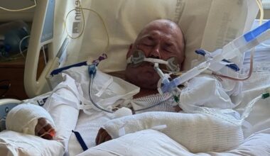 Taft police investigate man allegedly set on fire