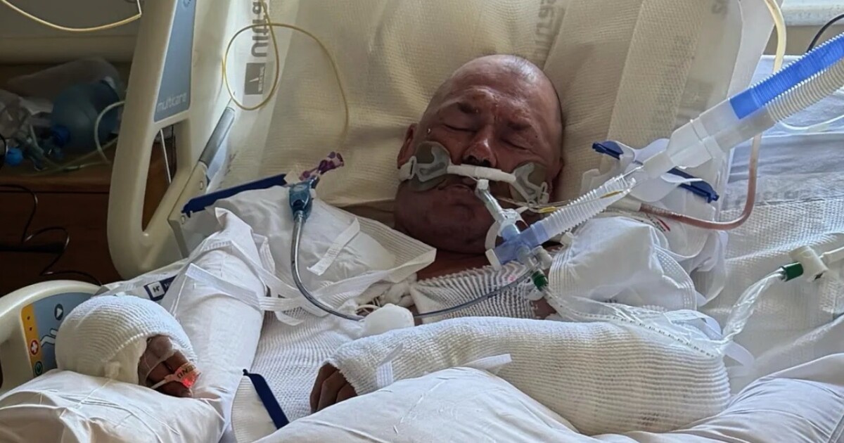 Taft police investigate man allegedly set on fire