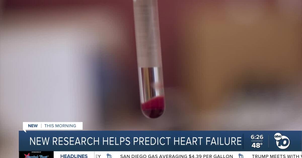 Blood test may predict heart problems, new UC San Diego Health study shows
