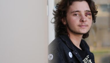 California protester left blind in one eye is among string of violent run-ins with federal agents