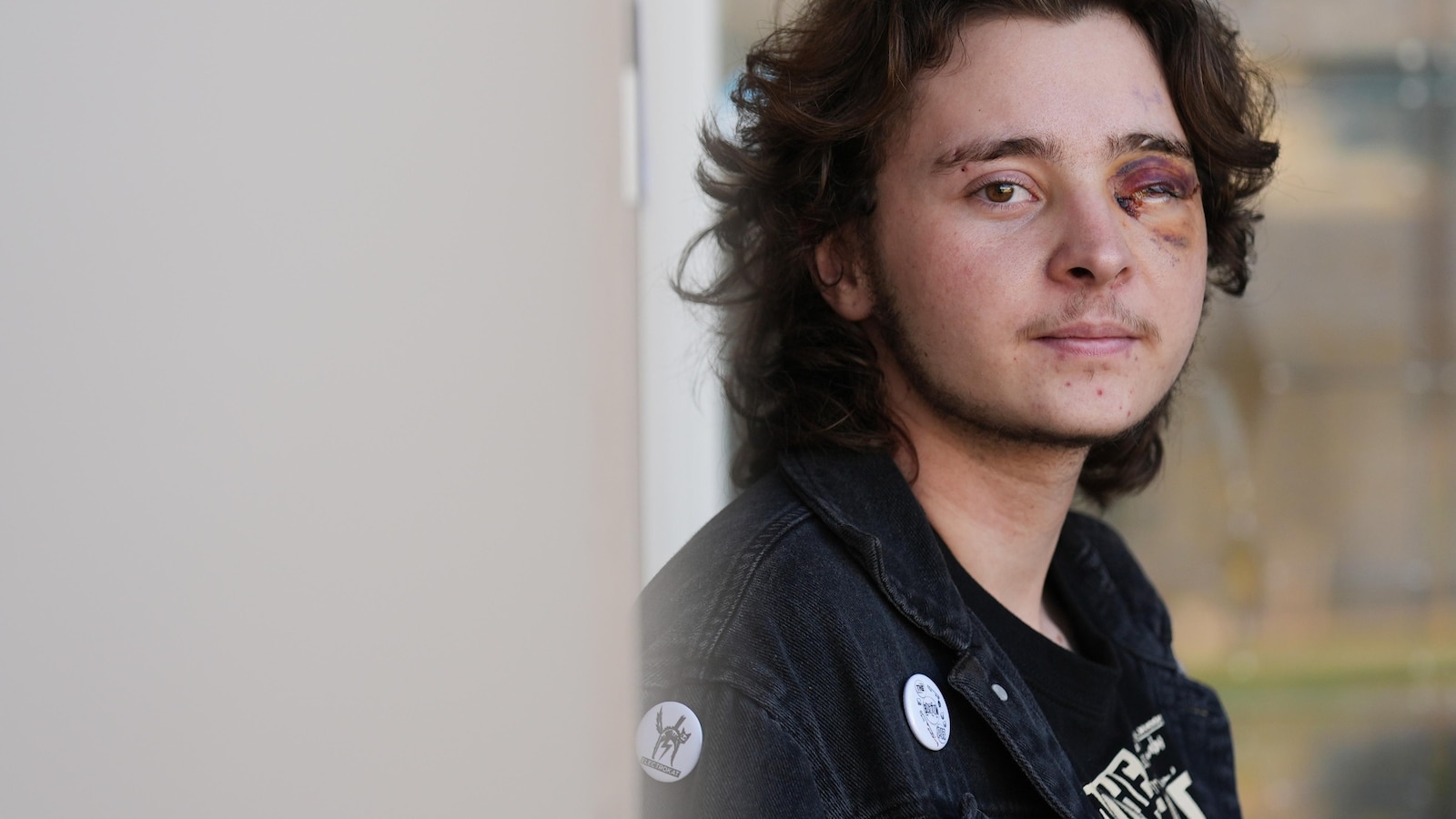 California protester left blind in one eye is among string of violent run-ins with federal agents