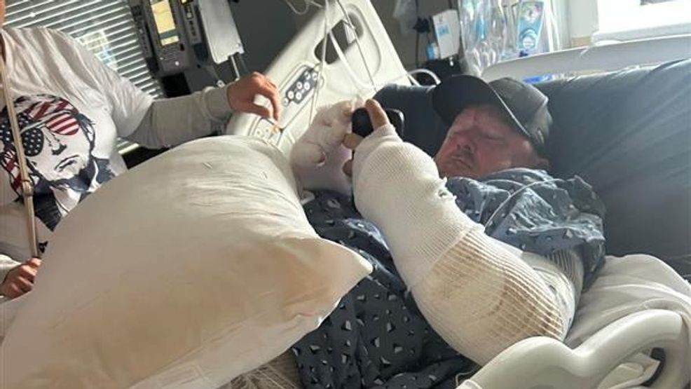 On January 22, 2026, a woman allegedly set Billy Terry on fire after throwing gas on him. The accused, allegedly worked at Terry's brand new Hungry Grizzly Bear Company restaurant in Taft. Photo Credit: Willella Gorden{p}{/p}