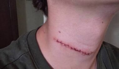 Family seeks answers after son’s neck slashed in Daytona Beach by man recently released from jail