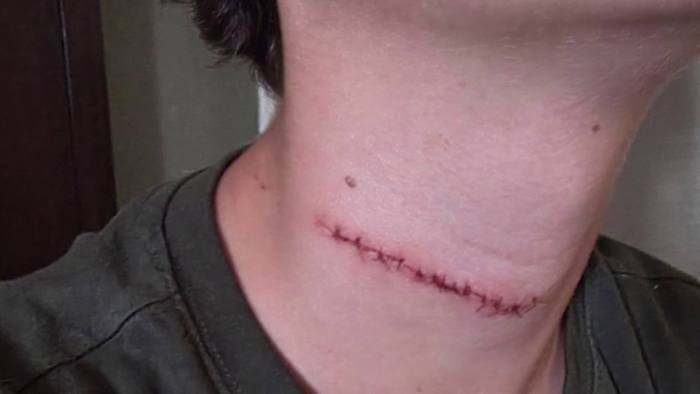 Family seeks answers after son’s neck slashed in Daytona Beach by man recently released from jail