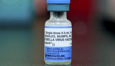 Possible mumps exposure at Berkeley High, principal says