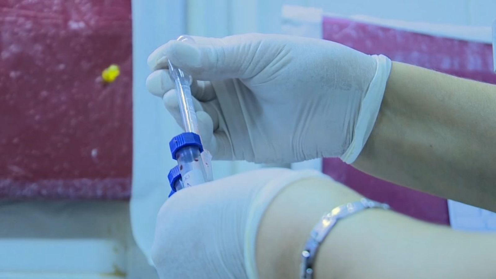 San Francisco losing $8 million in HIV grant funding; California suing federal government over CDC grant cuts